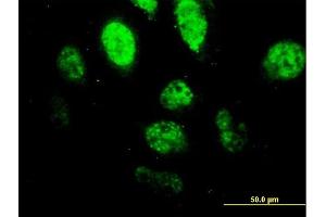 Immunofluorescence of monoclonal antibody to SPI1 on HeLa cell.