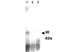 Western blot using MER2 (phospho S30) polyclonal antibody  shows detection of phos-phorylated MER2, but not phosphatase treated or mutant cells. (CD151 anticorps  (pSer30))