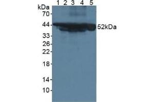 Western blot analysis of (1) Mouse Serum, (2) Mouse Intestine Tissue, (3) Mouse Pancreas Tissue, (4) Mouse Liver Tissue and (5) Human HeLa cells. (Cytokeratin 18 anticorps  (AA 1-423))