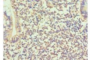 Immunohistochemistry of paraffin-embedded human small intestine tissue using ABIN7145683 at dilution of 1:100 (BMP15 anticorps  (AA 143-392))