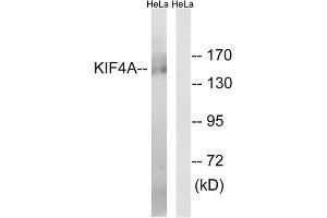 Western blot analysis of extracts from HeLa cells, using KIF4A antibody. (KIF4A anticorps  (C-Term))
