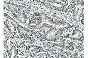 IHC analysis of ATF1 using anti-ATF1 antibody (ABIN7599192).