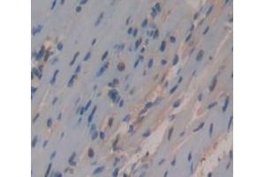 IHC-P analysis of Kidney tissue, with DAB staining. (HNRNPA1 anticorps  (AA 2-320))