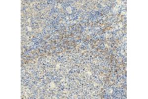 IHC analysis of CD154/CD40LG using anti-CD154/CD40LG antibody (ABIN5692813).