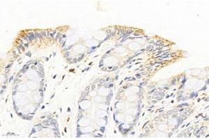 Immunohistochemistry analysis of paraffin-embedded rat colon using,ME2 (ABIN7074757) at dilution of 1: 6000