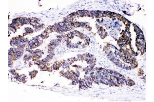 IHC analysis of Cytokeratin 8 using anti-Cytokeratin 8 antibody (ABIN5518853).