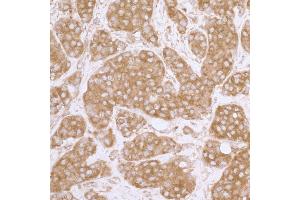 Immunohistochemistry (IHC) image for anti-Eukaryotic Translation Initiation Factor 3 Subunit A (EIF3A) (AA 860-910) antibody (ABIN7453842) (EIF3A anticorps  (AA 860-910))