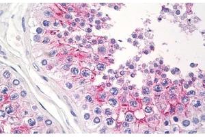 Human Testis: Formalin-Fixed, Paraffin-Embedded (FFPE) (CD147 anticorps)