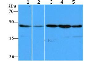 The Cell lysates (40ug) were resolved by SDS-PAGE, transferred to PVDF membrane and probed with anti-human EEF1A1 antibody (1:1000). (eEF1A1 anticorps)