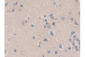 Detection of CACYBP in Human Cerebrum Tissue using Polyclonal Antibody to Calcyclin Binding Protein (CACYBP)