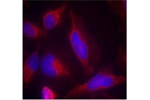 Image no. 2 for anti-Fms-Related tyrosine Kinase 3 (FLT3) (AA 589-593) antibody (ABIN401557) (FLT3 anticorps  (AA 589-593))