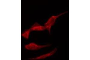 ABIN6275337 staining Hela by IF/ICC.