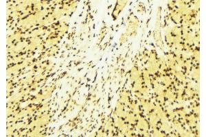 ABIN6274239 at 1/100 staining Human gastric tissue by IHC-P.