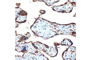 Immunohistochemistry of paraffin-embedded human placenta using NAIP Rabbit mAb (ABIN7268931) at dilution of 1:100 (40x lens). (NAIP anticorps)