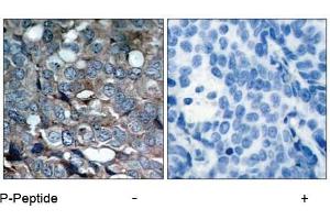 Image no. 1 for anti-Mitogen-Activated Protein Kinase Kinase Kinase 5 (MAP3K5) (pSer83) antibody (ABIN196913) (ASK1 anticorps  (pSer83))