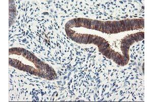Image no. 2 for anti-Latexin (LXN) antibody (ABIN1499100)