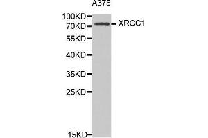Western Blotting (WB) image for anti-X-Ray Repair Complementing Defective Repair in Chinese Hamster Cells 1 (XRCC1) (AA 1-320) antibody (ABIN1683300) (XRCC1 anticorps  (AA 1-320))