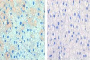 Left image is paraformaldehyde-fixed and paraffin-embedded cow lactating with CPT1A Pab , which was peroxidase-conjugated to the secondary antibody, followed by AEC staining, right image is contrast, did not add the antibody. (CPT1A anticorps  (C-Term))