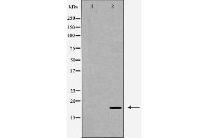 Western blot analysis of Caspase 6 (Cleaved-Asp179) expression in Hela cells.
