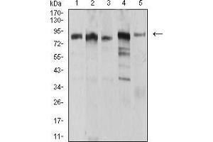 Western Blotting (WB) image for anti-Ubiquitin-Like, Containing PHD and RING Finger Domains, 1 (UHRF1) (AA 616-755) antibody (ABIN5905913) (UHRF1 anticorps  (AA 616-755))