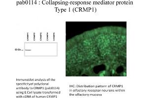 Image no. 1 for anti-Collapsin Response Mediator Protein 1 (CRMP1) (C-Term) antibody (ABIN347035) (CRMP1 anticorps  (C-Term))