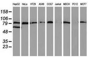 Image no. 6 for anti-Vascular Cell Adhesion Molecule 1 (VCAM1) antibody (ABIN1497155)