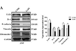 EMT-related marker expression in A549 cells with YAP1 overexpression or silencing. (GAPDH anticorps)
