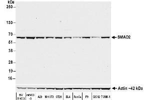 Western Blotting (WB) image for anti-SMAD, Mothers Against DPP Homolog 2 (SMAD2) (AA 225-275) antibody (ABIN7454016)
