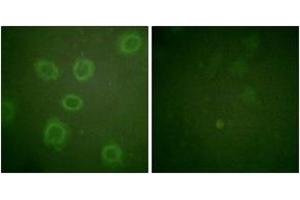 Immunofluorescence analysis of HuvEc cells, using HER2 (Phospho-Thr686) Antibody. (ErbB2/Her2 anticorps  (pThr686))