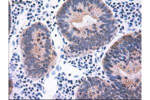 Image no. 9 for anti-Keratin 18 (KRT18) (AA 69-372) antibody (ABIN1491637)