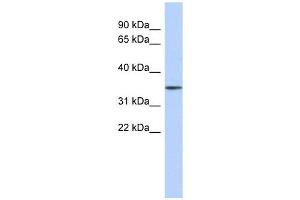 FBXO31 antibody used at 1 ug/ml to detect target protein. (FBXO31 anticorps  (Middle Region))