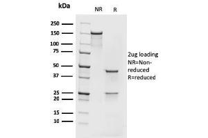 SDS-PAGE Analysis Purified MCM7 Recombinant Mouse Monoclonal Antibody (rMCM7/1468).
