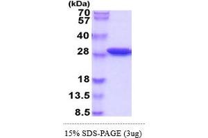 SDS-PAGE (SDS) image for Sepiapterin Reductase (SPR) (AA 1-262) protein (His tag) (ABIN5854975)