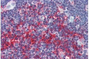 Human Thymus: Formalin-Fixed, Paraffin-Embedded (FFPE)