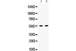 Western blot analysis of SMYD3 expression in HELA whole cell lysates (lane 1) and COLO320 whole cell lysates (lane 2). (SMYD3 anticorps  (C-Term))