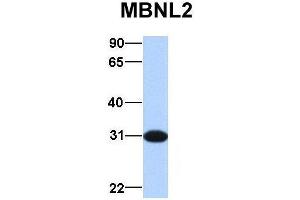 Host:  Rabbit  Target Name:  MBNL2  Sample Type:  Human Fetal Brain  Antibody Dilution:  1. (MBNL2 anticorps  (Middle Region))