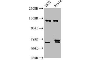 Western Blot Positive WB detected in: 293T whole cell lysate, Rat brain tissue All lanes: TCERG1 antibody at 5. (TCERG1 anticorps  (AA 782-896))