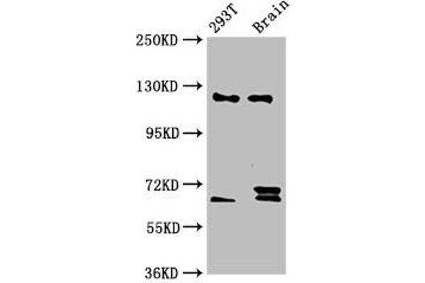 TCERG1 anticorps  (AA 782-896)