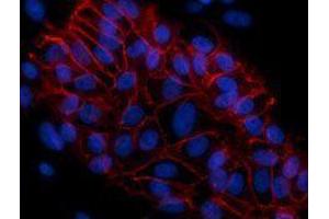 Immunofluorescence (IF) image for anti-Cadherin 1, Type 1, E-Cadherin (Epithelial) (CDH1) antibody (Alexa Fluor 594) (ABIN2656827)