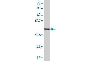 Western Blot detection against Immunogen (37.