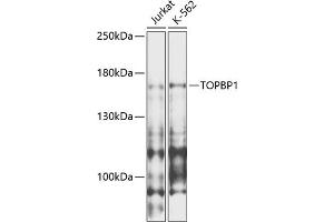Western blot analysis of extracts of various cell lines, using TOPBP1 antibody (ABIN6134114, ABIN6149397, ABIN6149400 and ABIN6216254) at 1:1000 dilution. (TOPBP1 anticorps  (AA 1-100))