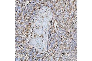 IHC analysis of PTRF/CAVIN1 using anti-PTRF/CAVIN1 antibody (ABIN7601817). (PTRF anticorps  (AA 47-390))