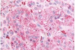 Human Adrenal (formalin-fixed, paraffin-embedded) stained with GPR84 antibody ABIN213440 at 10 ug/ml followed by biotinylated goat anti-rabbit IgG secondary antibody ABIN481713, alkaline phosphatase-streptavidin and chromogen.