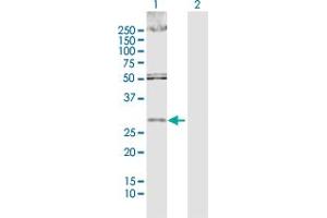 Western Blot analysis of DKK1 expression in transfected 293T cell line by DKK1 MaxPab polyclonal antibody. (DKK1 anticorps  (AA 1-266))