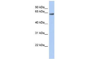WB Suggested Anti-TBC1D10B Antibody Titration:  0. (TBC1D10B anticorps  (Middle Region))