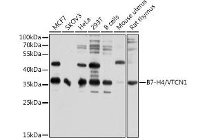 Western blot analysis of extracts of various cell lines, using B7-H4/VTCN1 antibody (ABIN6129975, ABIN6150157, ABIN6150158 and ABIN6214657) at 1:1000 dilution. (VTCN1 anticorps  (AA 100-260))