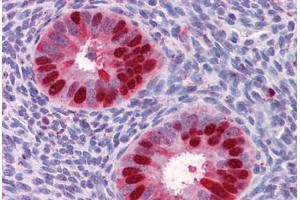 Human Uterus: Formalin-Fixed, Paraffin-Embedded (FFPE) (Deoxyuridine Triphosphatase (DUT) (AA 68-164) anticorps)