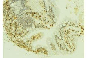 ABIN6277221 at 1/100 staining Mouse colon tissue by IHC-P. (FOXM1 anticorps  (N-Term))