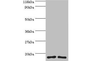 Western blot All lanes: RPS16 protein antibody at 2 μg/mL Lane 1: 293T whole cell lysate Lane 2: EC109 whole cell lysate Secondary Goat polyclonal to rabbit IgG at 1/15000 dilution Predicted band size: 17 kDa Observed band size: 17 kDa (RPS16 anticorps  (AA 2-142))
