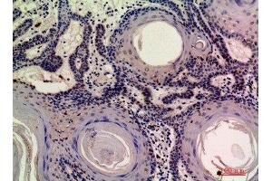 anti-MOB Kinase Activator 3A (MOB3A) (N-Term) antibody